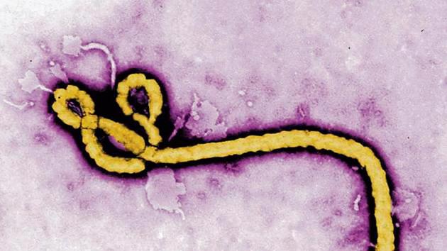 Micrograph image of an Ebola virus.(AP Photo)