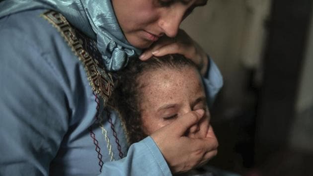 Maria El Maroufi, shares a moment with daughter Romaisae in their home. Most Moroccan children with XP don’t continue their education. While U.S. schools install window filters for XP pupils and otherwise adapt to their needs, such accommodations are rare in Morocco. (Mosa'ab Elshamy / AP)