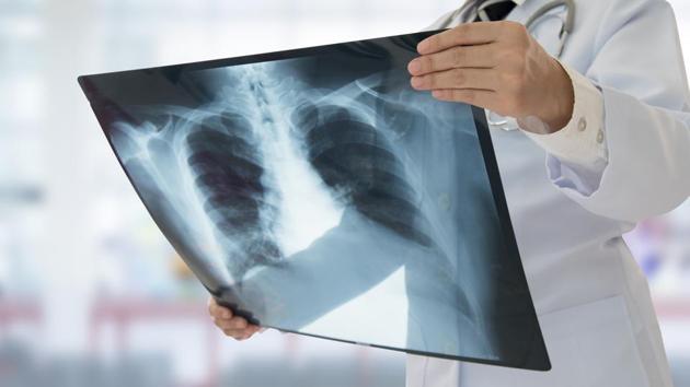 Sangrur-based X-ray centre to pay Rs.30,000 for the inaccurate ultrasound report . (Getty Images/iStockphoto(Representational image))