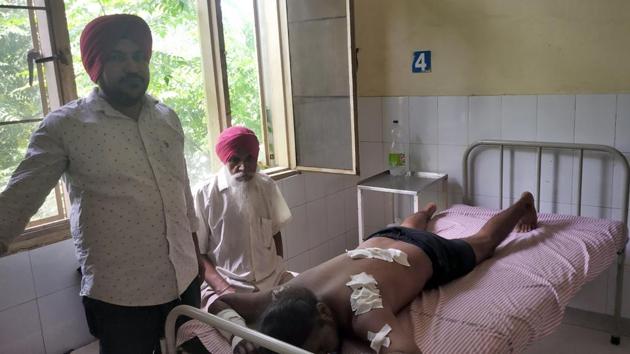 One of the victims, Manpreet, undergoing treatment at the civil hospital in Ludhiana on Wednesday.(HT PHOTO)