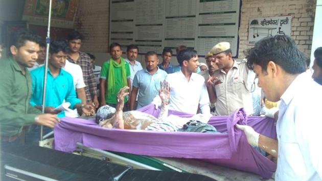 Rajesh, who set himself ablaze during the CM’s rally in Sonepat, at a hospital in Gohana on Monday.(HT Photo)