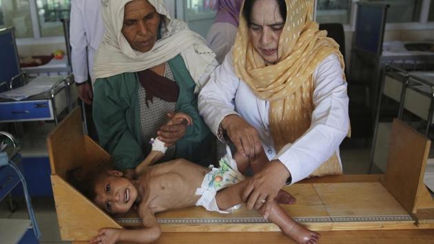 A hospital in nearby Charikar city treats more than 1,000 children a month for malnutrition and the problem is growing, nurse Fariba Hashimi said. “It’s mostly an economic issue, for mothers as well,” she said. “They can’t breastfeed because they don’t have enough income to feed themselves.” Aid has dropped in recent years, with supplemental biscuits and wheat flour that was once provided for patients now unavailable. (Rafiq Maqbool / AP) A hospital in nearby Charikar city treats more than 1,000 children a month for malnutrition and the problem is growing, nurse Fariba Hashimi said. “It’s mostly an economic issue, for mothers as well,” she said. “They can’t breastfeed because they don’t have enough income to feed themselves.” Aid has dropped in recent years, with supplemental biscuits and wheat flour that was once provided for patients now unavailable. (Rafiq Maqbool / AP)