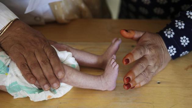 A nurse checks a malnourished baby at Indira Gandhi hospital in Kabul. Healthcare and other basic services are precarious in a country where the World Bank says grants finance some 75% of public expenditures. This year it warned against the dire consequences of “any rapid decline in international aid flows.” Afghanistan has been the largest single recipient of American aid since the US-led invasion to oust the Taliban in 2001. (Rafiq Maqbool / AP) A nurse checks a malnourished baby at Indira Gandhi hospital in Kabul. Healthcare and other basic services are precarious in a country where the World Bank says grants finance some 75% of public expenditures. This year it warned against the dire consequences of “any rapid decline in international aid flows.” Afghanistan has been the largest single recipient of American aid since the US-led invasion to oust the Taliban in 2001. (Rafiq Maqbool / AP)