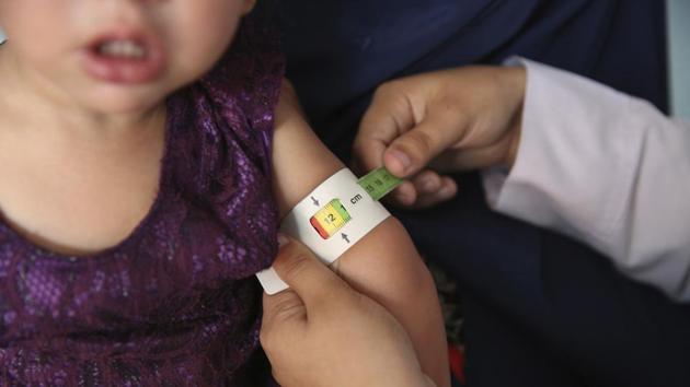 A doctor measures the arm of a malnourished girl at a UNICEF clinic. Despite billions of dollars in assistance more than half of Afghans still live in poverty. Much of the aid has gone to security efforts. If a US-Taliban agreement brings badly needed peace, Afghanistan could see an increase in aid, said Alex Thier, who once directed assistance for the country with the US Agency for International Development. (Rafiq Maqbool / AP) A doctor measures the arm of a malnourished girl at a UNICEF clinic. Despite billions of dollars in assistance more than half of Afghans still live in poverty. Much of the aid has gone to security efforts. If a US-Taliban agreement brings badly needed peace, Afghanistan could see an increase in aid, said Alex Thier, who once directed assistance for the country with the US Agency for International Development. (Rafiq Maqbool / AP)
