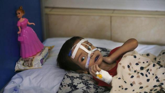 In the ward for malnourished children at the Indira Gandhi hospital, decorated with aid stickers from UNICEF and Japan, a nurse pointed out fragile toddlers. One 2-year-old, her face covered in tape to keep a nasal feeding tube in place, breathed with discomfort, a Barbie-like doll next to her on her pillow. (Rafiq Maqbool / AP) In the ward for malnourished children at the Indira Gandhi hospital, decorated with aid stickers from UNICEF and Japan, a nurse pointed out fragile toddlers. One 2-year-old, her face covered in tape to keep a nasal feeding tube in place, breathed with discomfort, a Barbie-like doll next to her on her pillow. (Rafiq Maqbool / AP)