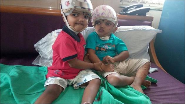 While Jagga is “like any other normal child”, Balia still cannot speak and would need prolonged rehabilitation, doctors said. (HT Photo) While Jagga is “like any other normal child”, Balia still cannot speak and would need prolonged rehabilitation, doctors said. (HT Photo)