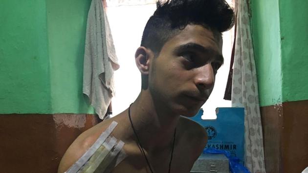 Burhan Nazir Parrey, 16, has a wound in his shoulder the size of a cricket ball. He is one of the lucky ones. Parrey told AFP that on a walk with a friend on August 6, a CRPF soldier put the barrel of a pellet-firing shotgun to his body and “fired a shell right into my right shoulder.” Then one of the soldiers “put his boot on my shoulder and pushed the shell further inside”, he said. (Parvaiz Bukhari / AFP) 