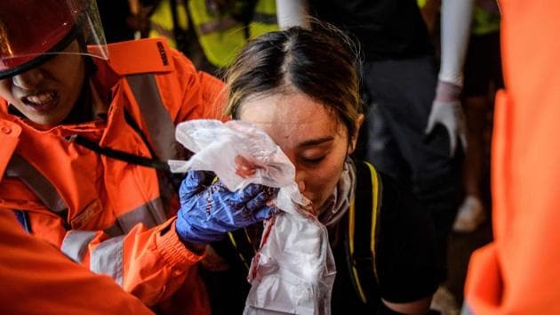 Medics look after a woman who received a facial injury during a standoff between protesters and police in Tsim Sha Tsui in Hong Kong on August 11. The 10th week showed no signs of a slowdown. On August 11, police stormed railway station, firing tear gas at protesters. That Sunday, one protester was injured in her eye becoming a symbol of the protest movement. (Anthony Wallace / AFP) Medics look after a woman who received a facial injury during a standoff between protesters and police in Tsim Sha Tsui in Hong Kong on August 11. The 10th week showed no signs of a slowdown. On August 11, police stormed railway station, firing tear gas at protesters. That Sunday, one protester was injured in her eye becoming a symbol of the protest movement. (Anthony Wallace / AFP)