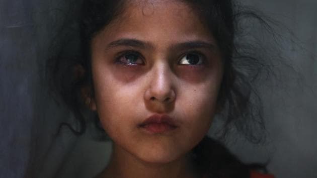 6-year-old Muneefa Nazir, a Kashmiri girl whose right eye was hit by a marble ball shot allegedly by paramilitary soldiers on August 12, stands outside her home in Srinagar. Reports from the region also suggest that children have been injured in actions by government forces. (Mukhtar Khan / AP) 6-year-old Muneefa Nazir, a Kashmiri girl whose right eye was hit by a marble ball shot allegedly by paramilitary soldiers on August 12, stands outside her home in Srinagar. Reports from the region also suggest that children have been injured in actions by government forces. (Mukhtar Khan / AP)