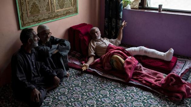 Mohammad Yousef, a 61-year-old man who was injured by pellets fired by security, rests inside his house in Anchar neighbourhood. “I was coming back to my neighbourhood after prayers. I thought I was safe as I am an old man. But they didn’t even spare me,” said Yousef while lying with his leg in bandages. (Danish Siddiqui / REUTERS)