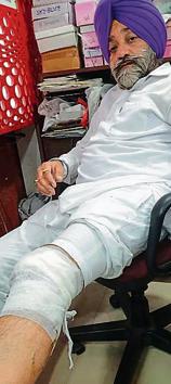 Senior deputy mayor Yoginder Singh Yogi showing his injuries in Patiala on Monday.(HT PHOTO)