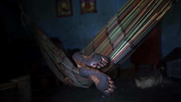 A fisherman’s feet are covered with oil after a morning of crab fishing in Lake Maracaibo. Today, the lake is an apocalyptic scene that’s getting worse as oil-soaked gunk of trash and driftwood lines its downwind shore. A breeze running across the fetid banks sends the headache-inducing smell of petroleum from perpetual oil spills through the waterside villages of simple cinderblock homes with corrugated metal roofs, exposing people who depend on the lake for food and jobs. (Rodrigo Abd / AP)