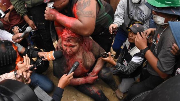 The mayor of the Bolivian town of Vinto and member of his ruling Movement for Socialism (MAS) party, Patricia Arce, speaks to the press as she is being humiliated by a mob of opposition supporters, in Vinto, close to Cochabamba. Bolivia’s President Evo Morales condemned the attack on Arce in which an opposition mob forcibly cut her hair, covered her in paint and marched her barefoot through the streets. (AFP)