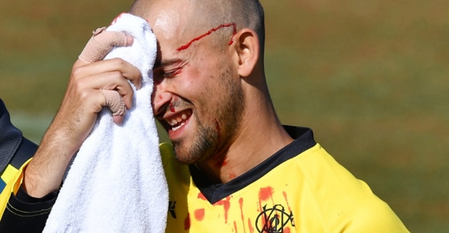 Ashton Agar gets bloodied during Marsh Cup.(Twitter)