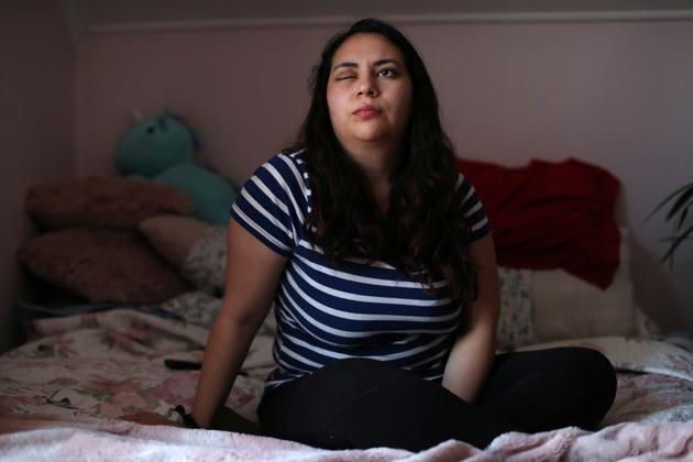 Natalia Aravena, who lost an eye after a riot police officer’s tear gas canister exploded into her face is seen inside her bedroom in Santiago. Many protesters say they have been blinded by rubber bullets and tear gas canisters. The Chilean Ophthalmological Society has registered 225 instances of severe eye trauma from Oct. 19 to Nov. 10 and said that may rise. (Ivan Alvarado / REUTERS) Natalia Aravena, who lost an eye after a riot police officer’s tear gas canister exploded into her face is seen inside her bedroom in Santiago. Many protesters say they have been blinded by rubber bullets and tear gas canisters. The Chilean Ophthalmological Society has registered 225 instances of severe eye trauma from Oct. 19 to Nov. 10 and said that may rise. (Ivan Alvarado / REUTERS)
