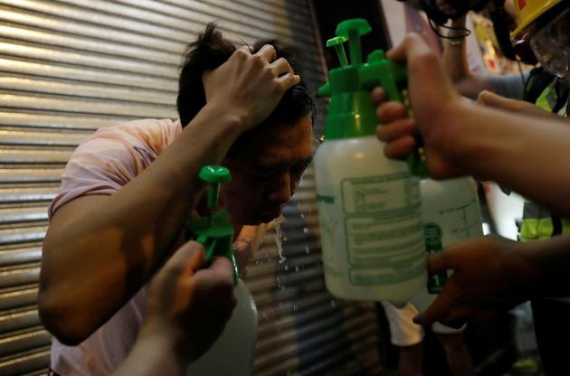 Pastor Alan Keung and first aid volunteers treat a pedestrian who was tear-gassed during an anti-government protest. Wearing a black helmet emblazoned with the word “Pastor” in English and Chinese, the 28-year-old is one of a group of volunteer medics helping people scrub from their faces the traces of gas, and bringing relief from its sting. “My mission is to bring God’s love to the crowd,” he said. (Kim Kyung-Hoon / REUTERS)