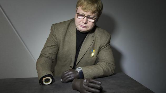 Volodymyr Zhemchugov shows his hand prostheses. Pro-Russian rebels took Zhemchugov captive in the Luhansk region after he was severely injured in a land mine explosion, losing his hands and eyesight. Zhemchugov spent almost a year in detention. Occasionally, Ukrainian authorities offer survivors help with health care and financial support, but aside from standard social benefits for those who served in the military, there aren’t any state programs to help former captives. (Zoya Shu / AP)