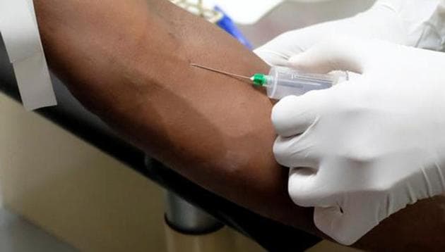 While the fee for the flow cytometry test has been doubled, rates for other tests have been increased by 30% to 60%. (HT FILE PHOTO) While the fee for the flow cytometry test has been doubled, rates for other tests have been increased by 30% to 60%. (HT FILE PHOTO)