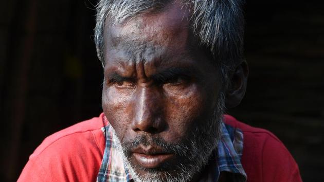 Habib-ur-Rehman during an interview outside his home. Outside of Assam, Muslims -- as well as defenders of India’s secular tradition -- are starting to panic, as seen in the current protests across the country of 1.3 billion people. Ambreen Agha, a professor at the O.P. Jindal Global University in Sonipat, said the citizenship law follows other worrying events. (Sajjad Hussain / AFP) Habib-ur-Rehman during an interview outside his home. Outside of Assam, Muslims -- as well as defenders of India’s secular tradition -- are starting to panic, as seen in the current protests across the country of 1.3 billion people. Ambreen Agha, a professor at the O.P. Jindal Global University in Sonipat, said the citizenship law follows other worrying events. (Sajjad Hussain / AFP)