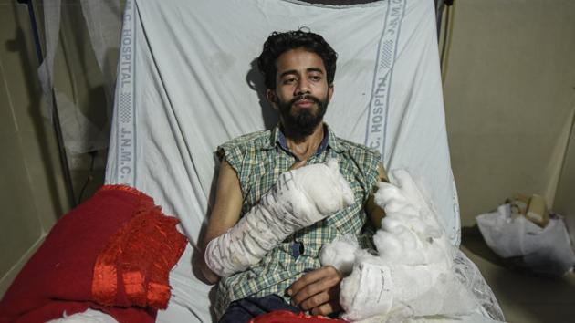 A student of Aligarh Muslim University (AMU) who was injured in a police crackdown on the students after a protest on December 15, admitted in Jawaharlal Nehru Medical College (JNMC), in Aligarh, Uttar Pradesh. (Burhaan Kinu / HT Photo) A student of Aligarh Muslim University (AMU) who was injured in a police crackdown on the students after a protest on December 15, admitted in Jawaharlal Nehru Medical College (JNMC), in Aligarh, Uttar Pradesh. (Burhaan Kinu / HT Photo)