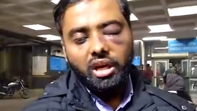 Mohammad Minhajuddin who lost vision in one eye allegedly due to police action at the Jamia Millia Islamia library. (TV video grab)