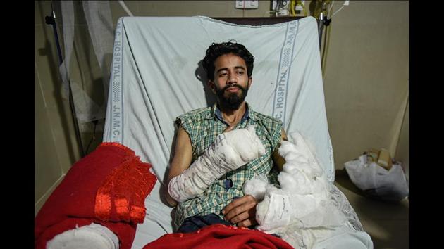 Tazeem Khan, 20, a third-year undergraduate in the Urdu department, at Jawaharlal Nehru Medical College (JNMC), AMU. On December 15, when violence during a protest march against the Citizenship Amendment Act (CAA) turned violent in Delhi’s Jamia Millia Islamia (JMI), AMU students were rounded by the police as they marched in solidarity with JMI. Khan and other students who were hiding inside a guest house were thrashed by the police, who called them “traitors”. (Burhaan Kinu / HT Photo) Tazeem Khan, 20, a third-year undergraduate in the Urdu department, at Jawaharlal Nehru Medical College (JNMC), AMU. On December 15, when violence during a protest march against the Citizenship Amendment Act (CAA) turned violent in Delhi’s Jamia Millia Islamia (JMI), AMU students were rounded by the police as they marched in solidarity with JMI. Khan and other students who were hiding inside a guest house were thrashed by the police, who called them “traitors”. (Burhaan Kinu / HT Photo)