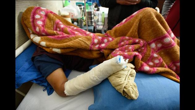 The most severely injured student is a 26-year-old chemistry research scholar, who claimed that he was simply caught in the melee, owing to which his right hand has been amputated at the wrist. Originally, no protests were scheduled for December 15. However, after news of violence in Jamia began to trickle in around 5:30 pm, students started giving out calls to stage a protest march in the campus in support of Jamia. (Burhaan Kinu / HT Photo) The most severely injured student is a 26-year-old chemistry research scholar, who claimed that he was simply caught in the melee, owing to which his right hand has been amputated at the wrist. Originally, no protests were scheduled for December 15. However, after news of violence in Jamia began to trickle in around 5:30 pm, students started giving out calls to stage a protest march in the campus in support of Jamia. (Burhaan Kinu / HT Photo)