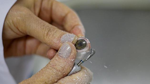 A doctor works on the construction of an eye implant. Vicentin is one of more than 50 patients treated by Salazar and his colleagues since 2015. The team specialises in maxillofacial prosthetics, a branch of dentistry focused on disfigurements by birth defects, disease or trauma. Their technique was published in 2016 in the peer-reviewed Journal of Otolaryngology - Head & Neck Surgery. (Miguel Schincariol/AFP) A doctor works on the construction of an eye implant. Vicentin is one of more than 50 patients treated by Salazar and his colleagues since 2015. The team specialises in maxillofacial prosthetics, a branch of dentistry focused on disfigurements by birth defects, disease or trauma. Their technique was published in 2016 in the peer-reviewed Journal of Otolaryngology - Head & Neck Surgery. (Miguel Schincariol/AFP)