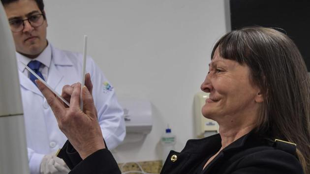 Denise Vicentin cries as she looks in the mirror for the first time after getting a prosthesis. Conventional techniques for making prosthesis models involve equipment costing up to $500,000, Salazar said. This one requires a computer and a smartphone. “The method demonstrates that you don’t need big investments to use advanced technology,” Salazar said. (Nelson Almeida/AFP) Denise Vicentin cries as she looks in the mirror for the first time after getting a prosthesis. Conventional techniques for making prosthesis models involve equipment costing up to $500,000, Salazar said. This one requires a computer and a smartphone. “The method demonstrates that you don’t need big investments to use advanced technology,” Salazar said. (Nelson Almeida/AFP)
