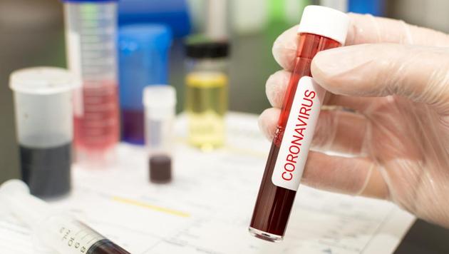 At least 10 cities in Hubei have suspended selling medicines for fever and cough, urging people who have such symptoms to go to the hospital as soon as possible (Getty Images/iStockphoto/ Representative Image) At least 10 cities in Hubei have suspended selling medicines for fever and cough, urging people who have such symptoms to go to the hospital as soon as possible (Getty Images/iStockphoto/ Representative Image)