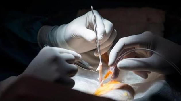 The moment a decision was made to harvest the baby’s organs, doctors moved quickly to perform the rare and complicated six-hour surgery.(Representative photo) The moment a decision was made to harvest the baby’s organs, doctors moved quickly to perform the rare and complicated six-hour surgery.(Representative photo)