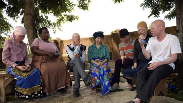 Chairperson for Machinga Association of Persons with Albinism Abdul Byson (R) talks during a meeting with members of the association in Machinga. The vulnerability of people with albinism is compounded by poverty and superstition. Since 2014, at least 26 people with albinism in Malawi have been killed while 11 remain missing, according to the national Association of Persons with Albinism. (Thoko Chikondi / AP) Chairperson for Machinga Association of Persons with Albinism Abdul Byson (R) talks during a meeting with members of the association in Machinga. The vulnerability of people with albinism is compounded by poverty and superstition. Since 2014, at least 26 people with albinism in Malawi have been killed while 11 remain missing, according to the national Association of Persons with Albinism. (Thoko Chikondi / AP)