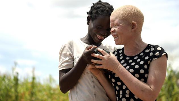Catherine Amidu (R) with her best neighbourhood friend Aisha at her home. At the request of the Association of Persons with Albinism, President Peter Mutharika last year appointed a commission of inquiry to investigate the abductions and killings. Its results have not yet been released. (Thoko Chikondi / AP) Catherine Amidu (R) with her best neighbourhood friend Aisha at her home. At the request of the Association of Persons with Albinism, President Peter Mutharika last year appointed a commission of inquiry to investigate the abductions and killings. Its results have not yet been released. (Thoko Chikondi / AP)