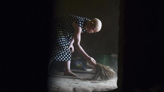 Catherine Amidu sweeps the floor inside her home. Mercy Mleme, secretary of the local chapter of the Association of Persons with Albinism, acknowledged the problems. “Being a rural area, we do not have electricity. Even in a case where we had power, most persons with albinism live in the remotest of areas and cannot manage to charge their gadgets,” Mleme said. (Thoko Chikondi / AP) Catherine Amidu sweeps the floor inside her home. Mercy Mleme, secretary of the local chapter of the Association of Persons with Albinism, acknowledged the problems. “Being a rural area, we do not have electricity. Even in a case where we had power, most persons with albinism live in the remotest of areas and cannot manage to charge their gadgets,” Mleme said. (Thoko Chikondi / AP)