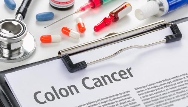 Medical studies say that colon cancer begins when healthy cells in the colon develop changes in their DNA.(Getty Images/iStockphoto)