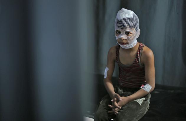 A wounded Syrian child sits at a makeshift clinic in the town of Maaret Misrin following Syrian government forces airstrikes on March 5 in the country's northwestern Idlib province. Russian air strikes killed at least 15 civilians including a child in the last major opposition bastion of Idlib in northwestern Syria, a Britain-based war monitor said. (Aref Tammawi / AFP) A wounded Syrian child sits at a makeshift clinic in the town of Maaret Misrin following Syrian government forces airstrikes on March 5 in the country's northwestern Idlib province. Russian air strikes killed at least 15 civilians including a child in the last major opposition bastion of Idlib in northwestern Syria, a Britain-based war monitor said. (Aref Tammawi / AFP)
