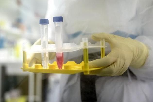 Currently, the only private lab in the city that has authorisation for conducting the test, SRL Laboratory, charges Rs 4,500 per patient. (Bloomberg)