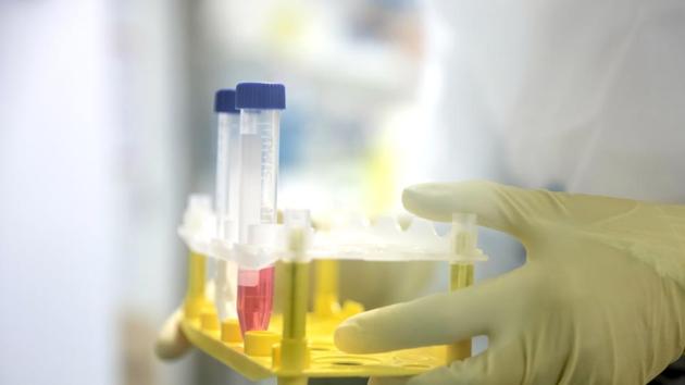 A French National Centre for Scientific Research (CNRS) researcher holds a test tube rack containing cells to be infected with Covid-19 during coronavirus vaccine research work inside the Pasteur Institute laboratories in Lille, France. (Bloomberg) A French National Centre for Scientific Research (CNRS) researcher holds a test tube rack containing cells to be infected with Covid-19 during coronavirus vaccine research work inside the Pasteur Institute laboratories in Lille, France. (Bloomberg)