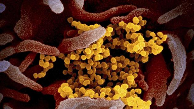 This undated electron microscope image made available by the US National Institutes of Health in February 2020 shows the Novel coronavirus SARS-CoV-2, yellow, emerging from the surface of cells, pink, cultured in the lab. (AP) This undated electron microscope image made available by the US National Institutes of Health in February 2020 shows the Novel coronavirus SARS-CoV-2, yellow, emerging from the surface of cells, pink, cultured in the lab. (AP)
