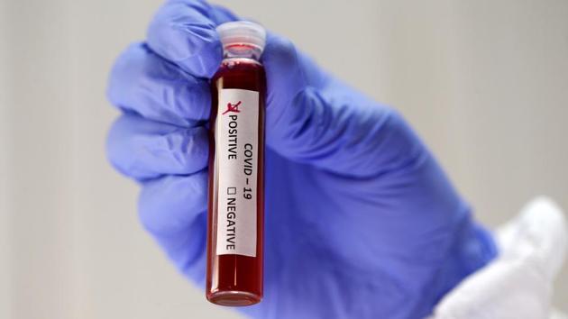 Fake blood is seen in test tubes labelled with the coronavirus (COVID-19) in this illustration taken March 17, 2020.(REUTERS)