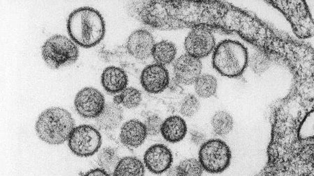 A man died in China after contracting the hantavirus. Here, the picture shows Sin Nombre hantavirus particle.(Picture courtesy: CDC)