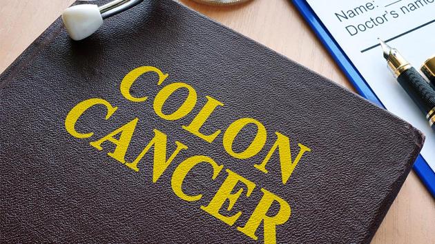 Colorectal cancer is treatable if it is detected early.(iStock)