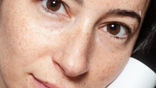 With the assistance of this system, the diagnostic accuracy of dermatologists, as well as the general public, was significantly improved. (UNSPLASH) With the assistance of this system, the diagnostic accuracy of dermatologists, as well as the general public, was significantly improved. (UNSPLASH)