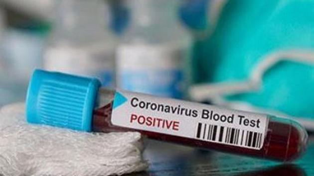 Haryana has so far reported 29 positive cases of coronavirus.(ANI Photo)