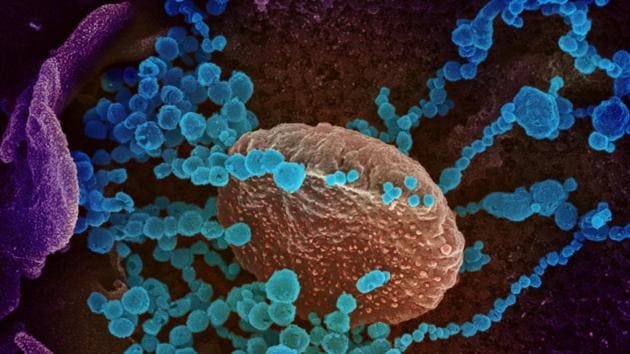 This scanning electron microscope image shows SARS-CoV-2 (round blue objects), also known as novel coronavirus, the virus that causes COVID-19, emerging from the surface of cells cultured in the lab which was isolated from a patient in US.(via REUTERS)