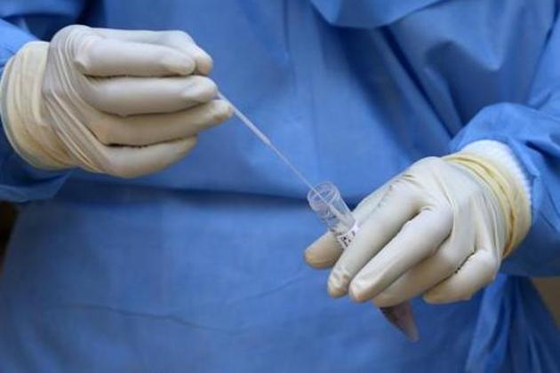 A doctor wearing a protective suit stores a swab in a test tube after taking it from a man to test for coronavirus disease (COVID-19), at a residential area in Mumbai, India, April 8, 2020. (REUTERS) A doctor wearing a protective suit stores a swab in a test tube after taking it from a man to test for coronavirus disease (COVID-19), at a residential area in Mumbai, India, April 8, 2020. (REUTERS)