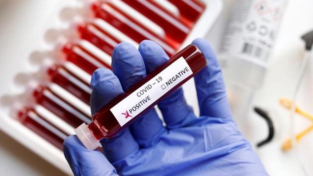 Guleria said that plasma therapy has previously been used in other illnesses such as Ebola. (REUTERS) Guleria said that plasma therapy has previously been used in other illnesses such as Ebola. (REUTERS)