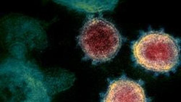 This undated electron microscope image made available by the US National Institutes of Health in February 2020 shows the virus that causes COVID-19. The sample was isolated from a patient in the US.(AP FILE) This undated electron microscope image made available by the US National Institutes of Health in February 2020 shows the virus that causes COVID-19. The sample was isolated from a patient in the US.(AP FILE)