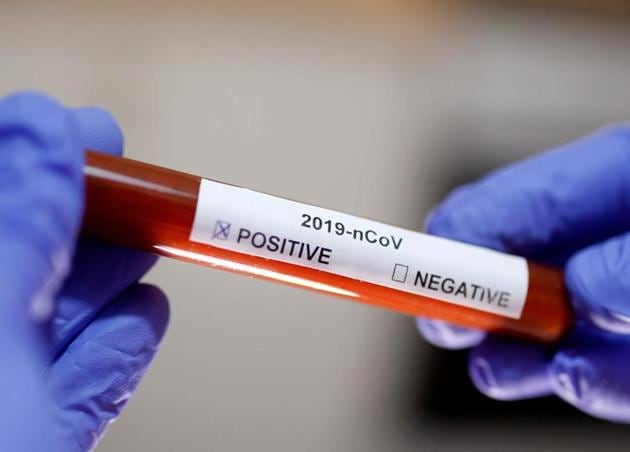 Both the women were admitted at a hospital near Bhagwan Talkies crossing, one of the hotspots with over 20 infected staff and contacts. (Representative image) Both the women were admitted at a hospital near Bhagwan Talkies crossing, one of the hotspots with over 20 infected staff and contacts. (Representative image)