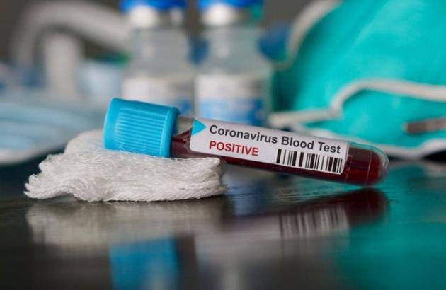 According to the data, 44% of the positive patients were of the age group of 21-40 years and 27% of positive cases were of people in the age group of 41-60 years. (Representative image/istock Photo) According to the data, 44% of the positive patients were of the age group of 21-40 years and 27% of positive cases were of people in the age group of 41-60 years. (Representative image/istock Photo)